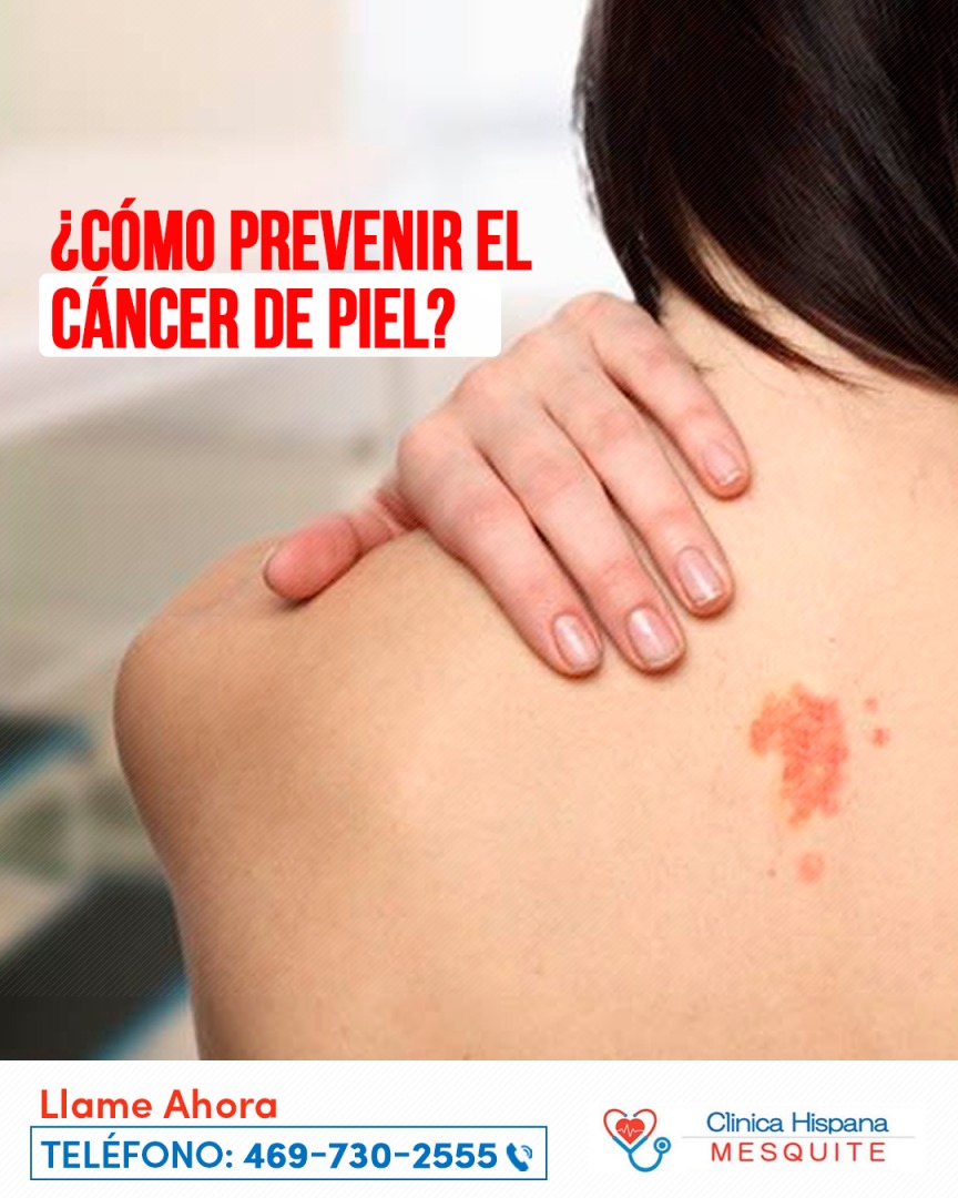 Prevenir el cáncer de piel